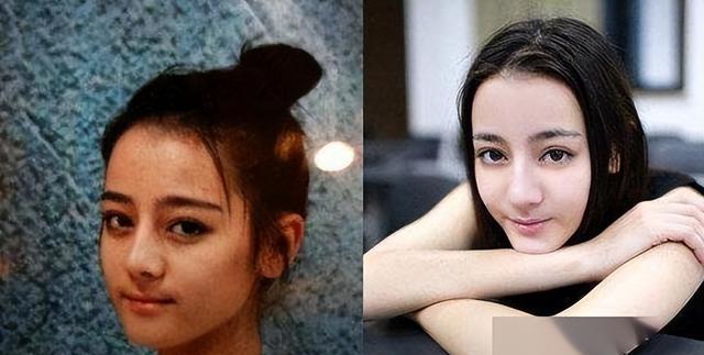 Baby素颜回应整容